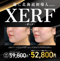 XERF(ザーフ)