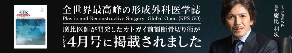 廣比医師が開発したオトガイ前額断骨切り術が4月号に掲載されました。