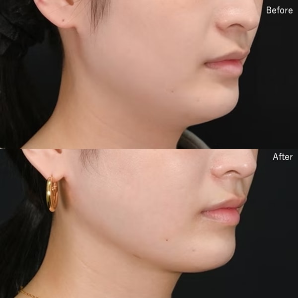 今月のベスト症例写真