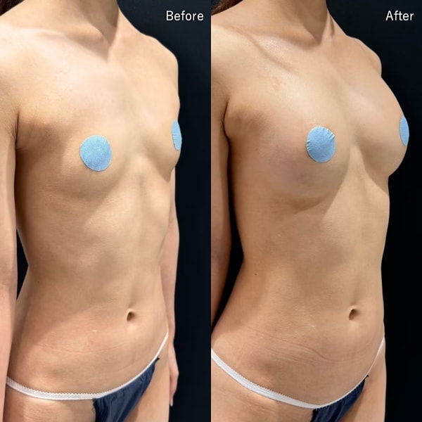 今月のベスト症例写真