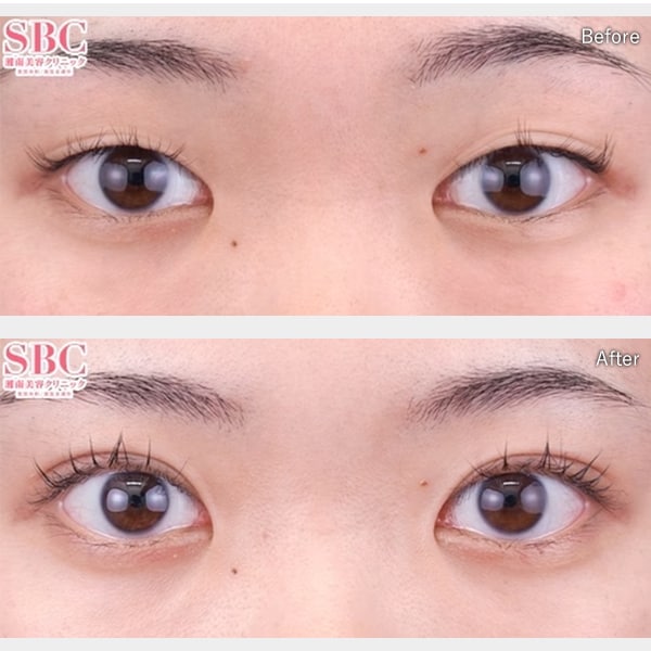 今月のベスト症例写真