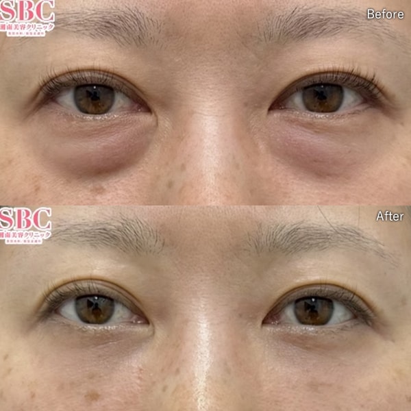 坂本 龍亮医師 症例写真