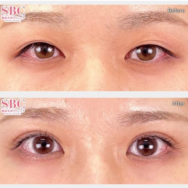 鴨田 隆弘医師 症例写真