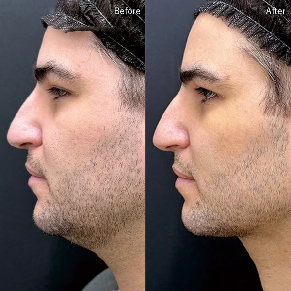 檜山 和弘医師 症例写真