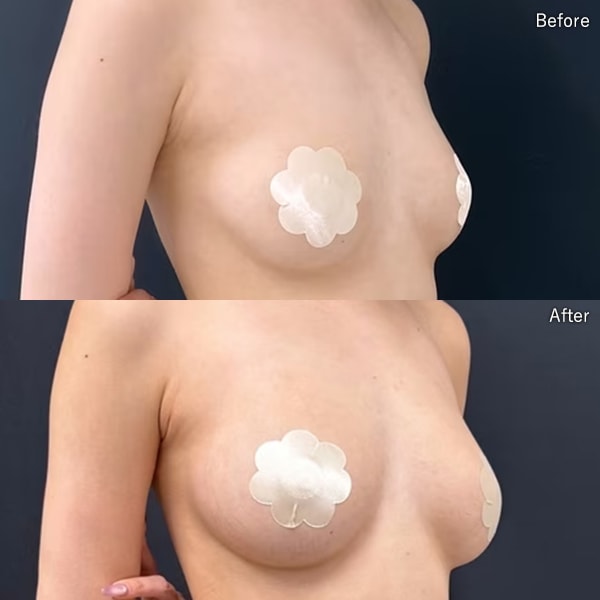 大谷 悠輔医師 症例写真