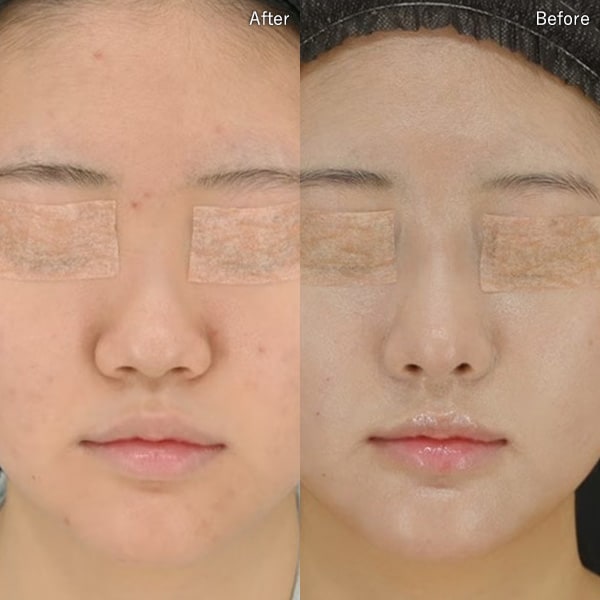 居川 和広医師 症例写真