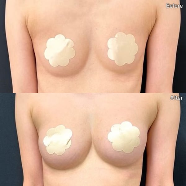 大谷 悠輔医師 症例写真