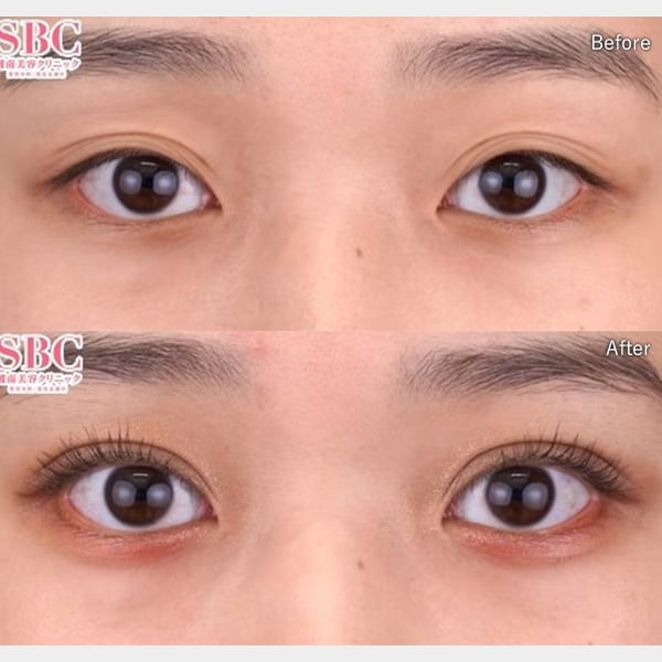 赤尾 健医師 症例写真