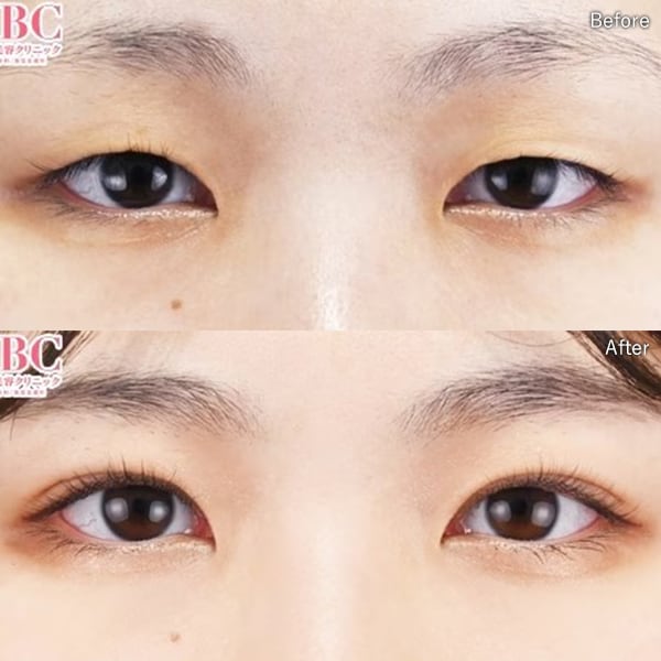 今月のベスト症例写真