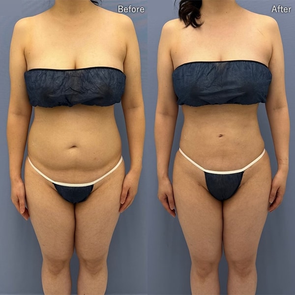 今月のベスト症例写真