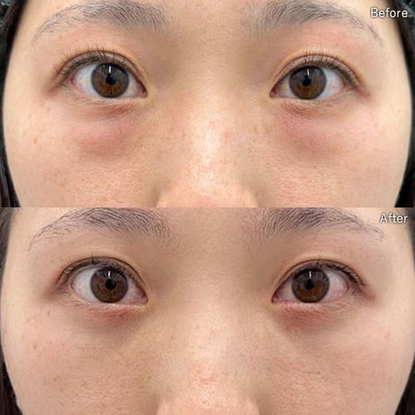 今月のベスト症例写真