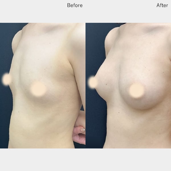 今月のベスト症例写真