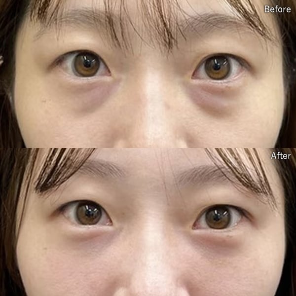 櫻井 将継医師 症例写真