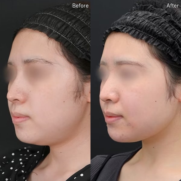 河邉 護医師 症例写真