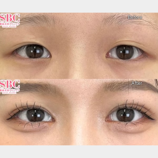 足立 紫音医師 症例写真