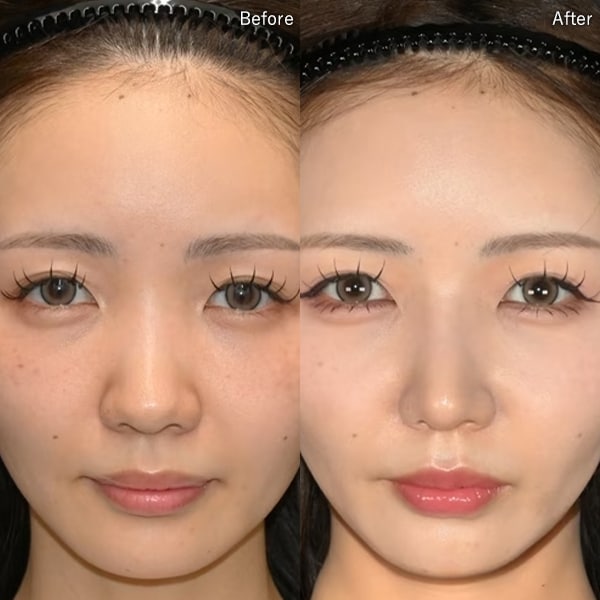 中野 達生医師 症例写真