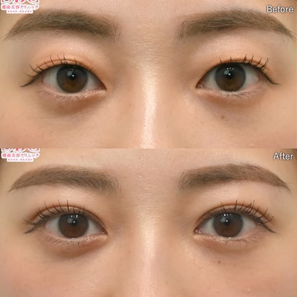 梶山 典彦医師 症例写真