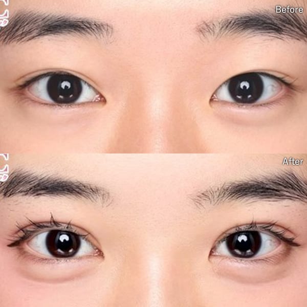 金 児美医師 症例写真