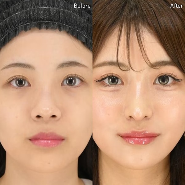 居川和広医師 症例写真