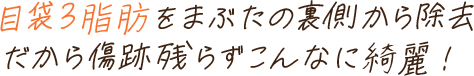 目袋3脂肪をまぶたの裏側から除去だから傷跡残らずこんなに綺麗！