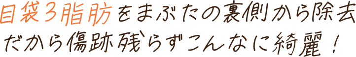 目袋3脂肪をまぶたの裏側から除去だから傷跡残らずこんなに綺麗！