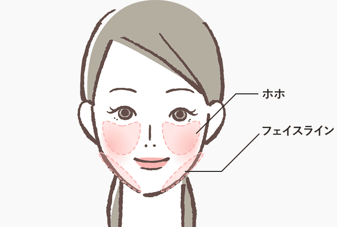 フェイスラインのたるみに効果的な治療