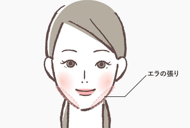 エラの張り解消に効果的な治療