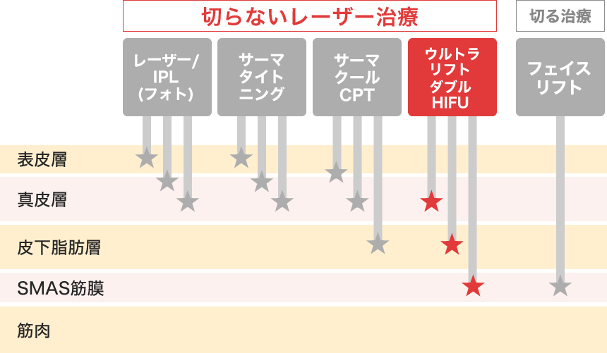 ウルトラリフト ダブルhifu 医療レーザー外来なら湘南美容クリニック 公式