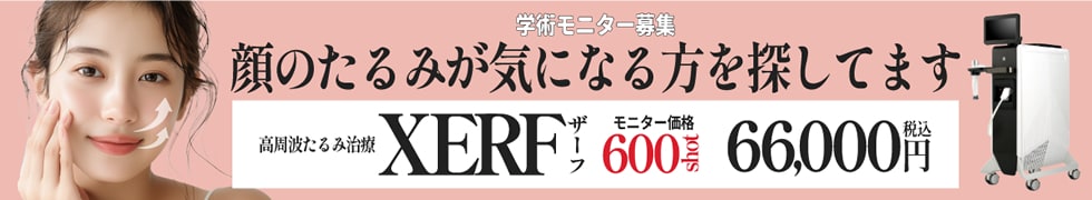 XERF（ザーフ）