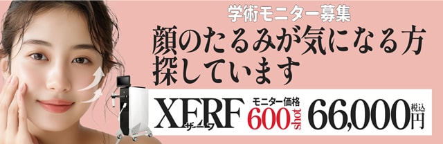 XERF（ザーフ）