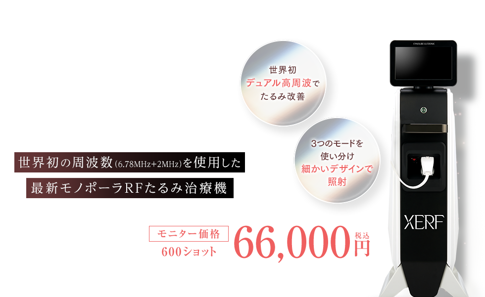 XERF（ザーフ）