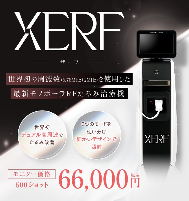 XERF（ザーフ）