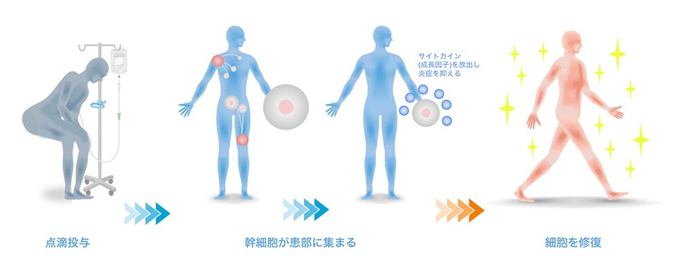 培養幹細胞静脈点滴療法とは？ イラスト1