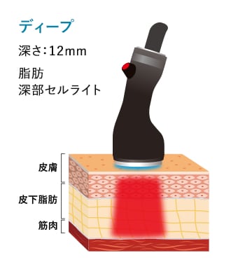 体用ハンドピース イメージ2