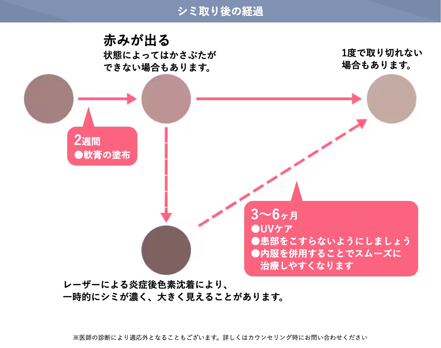 しみ取りレーザー後のダウンタイム