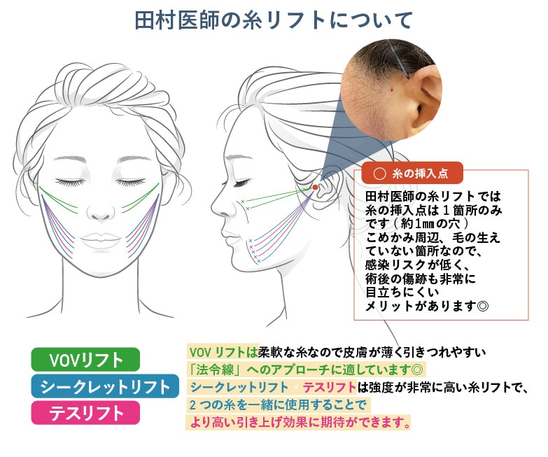 1本1本、「適した箇所に最良の糸」