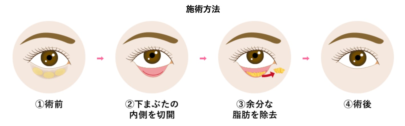 気になる治療方法とは？