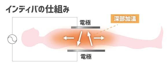 インディバとは…