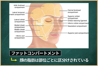 頬の脂肪吸引で気をつけてほしいこと