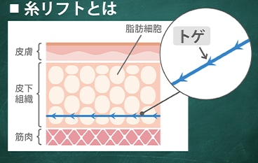 脂肪吸引は抵抗がある方、不安な方へ