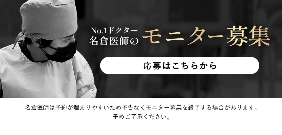 クマ改善や若返り・たるみ改善・二重など秋葉原院のモニター募集一覧