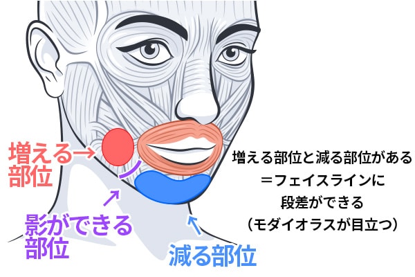 モダイオラスが目立つ理由とは？