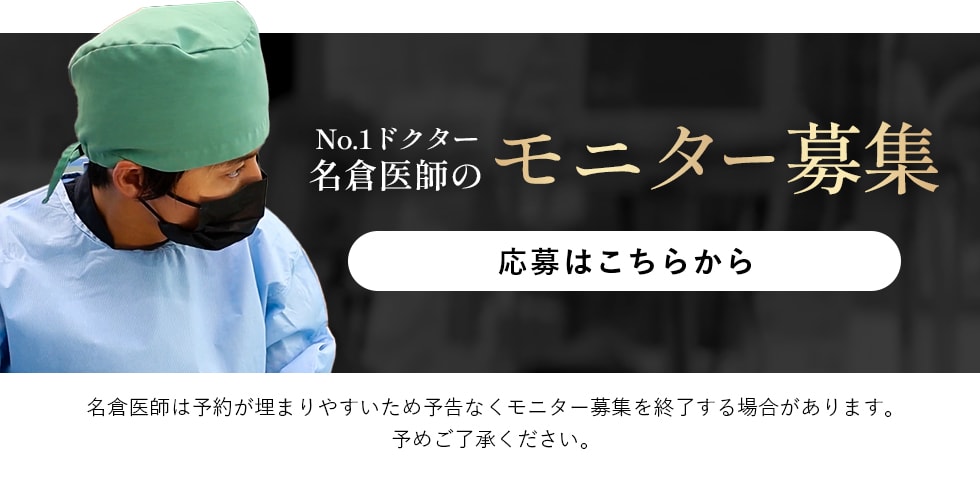 クマ改善や若返り・たるみ改善・二重など秋葉原院のモニター募集一覧