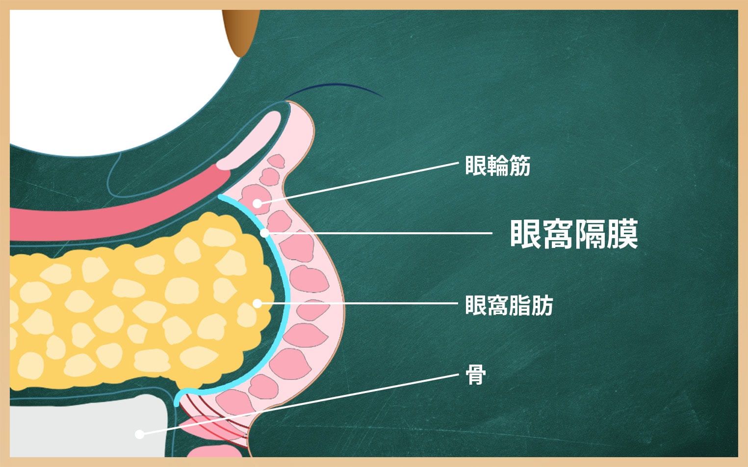 眼窩脂肪はどのようになっている？