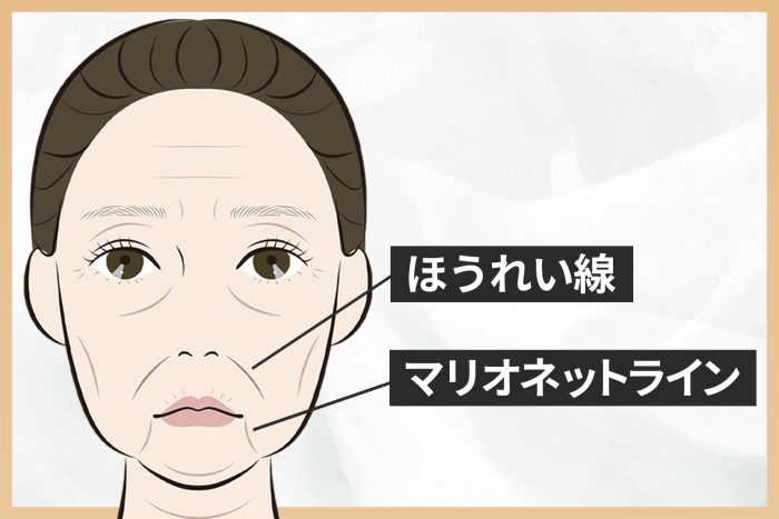 Changes in facial contours and their impact on the overall impression.