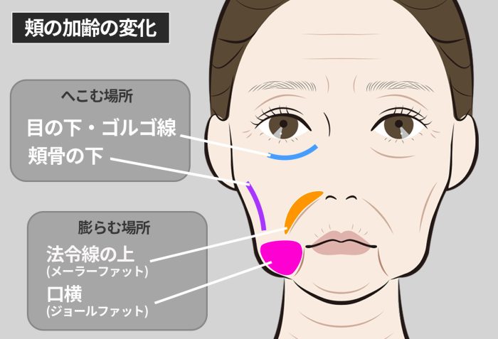 たるみや移動が引き起こす問題