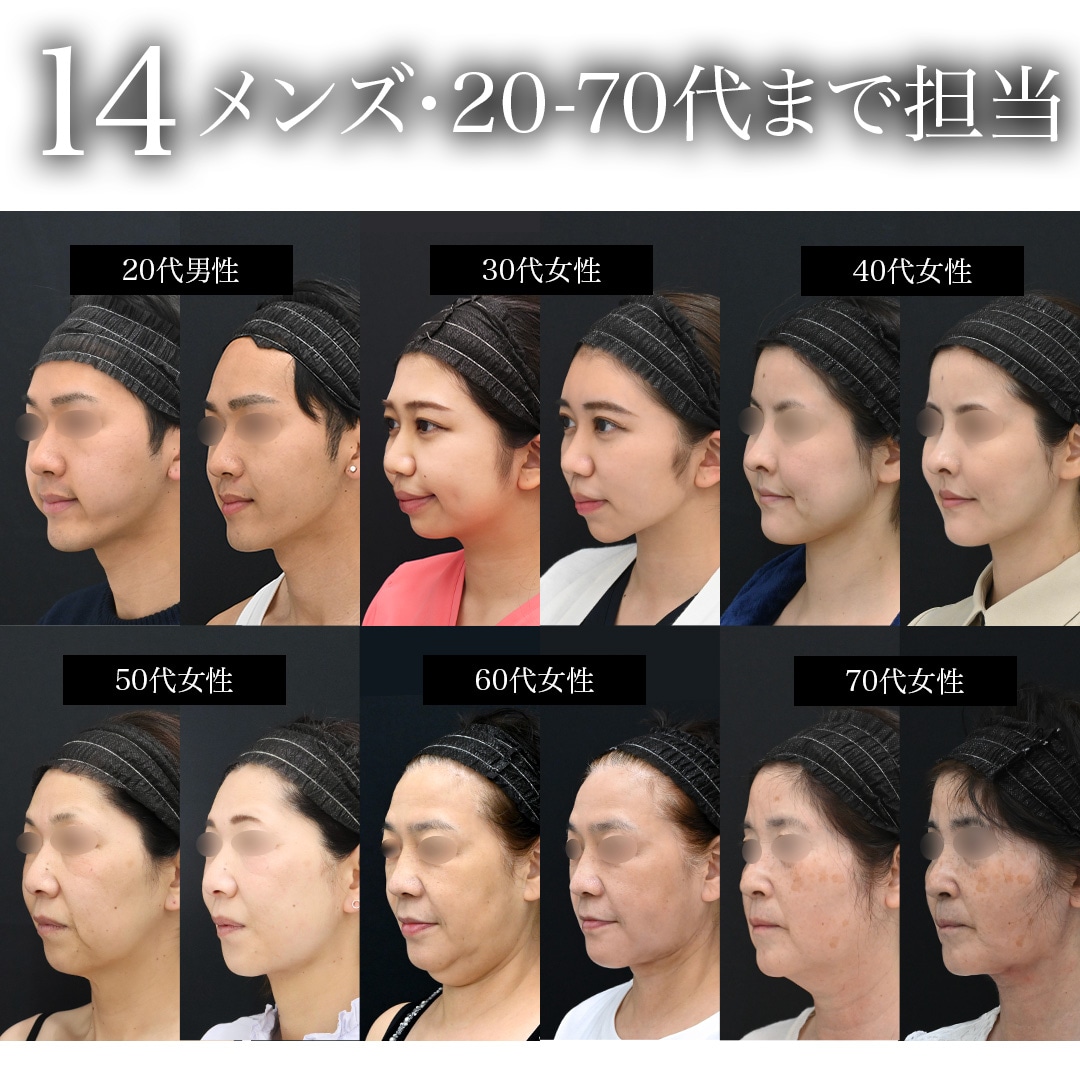 14. 覆盖 20～70 岁及男性患者