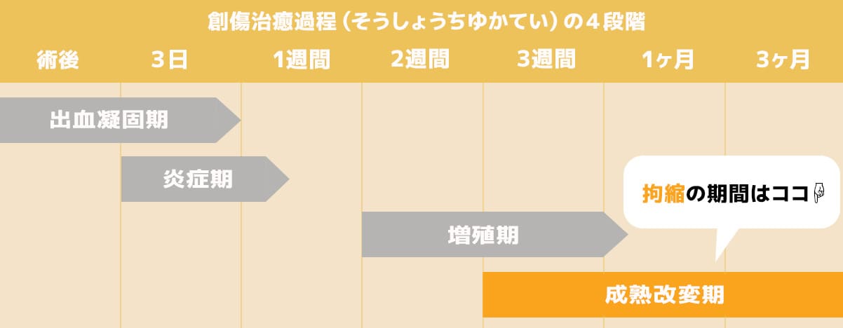 ④成熟改変期