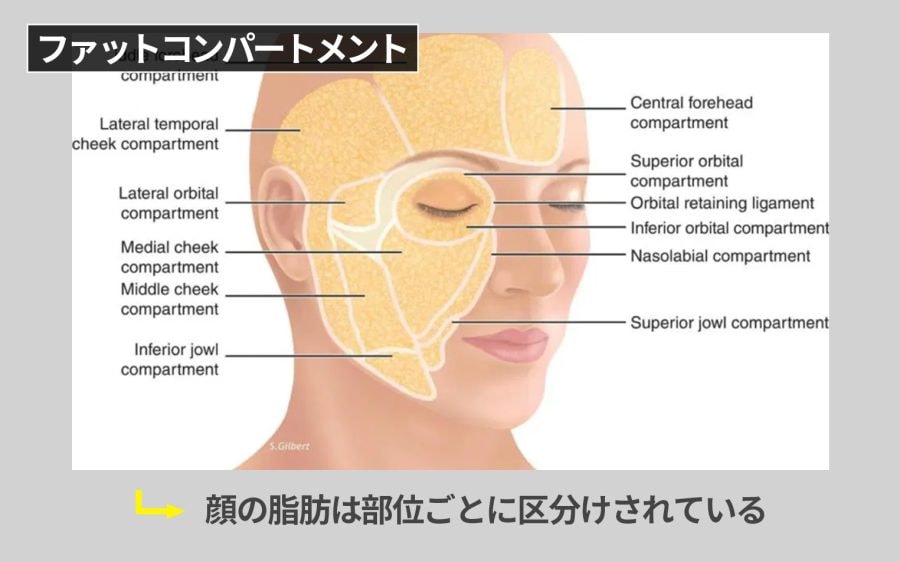 脂肪の「落ちやすい部分」と「落ちにくい部分」