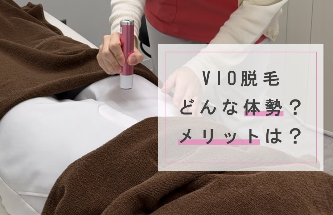 VIO脱毛は恥ずかしい？湘南美容クリニック青森院VIO脱毛の照射の仕方をご紹介！